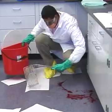 پاک کردن خون از روی پی وی سی بیمارستان